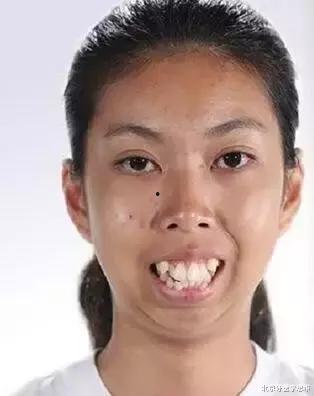 黑脸龅牙妹吃瓜,揭秘娱乐圈幕后故事